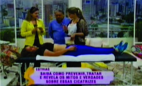 Estrias - TV DIÁRIO