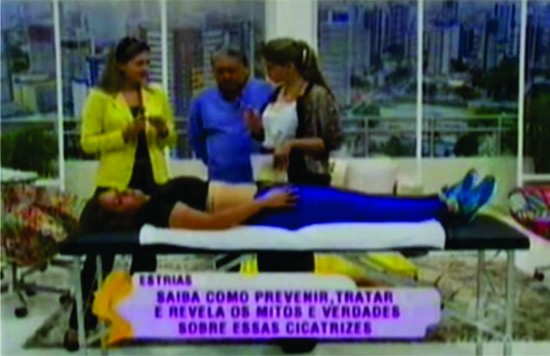 Estrias - TV DIÁRIO